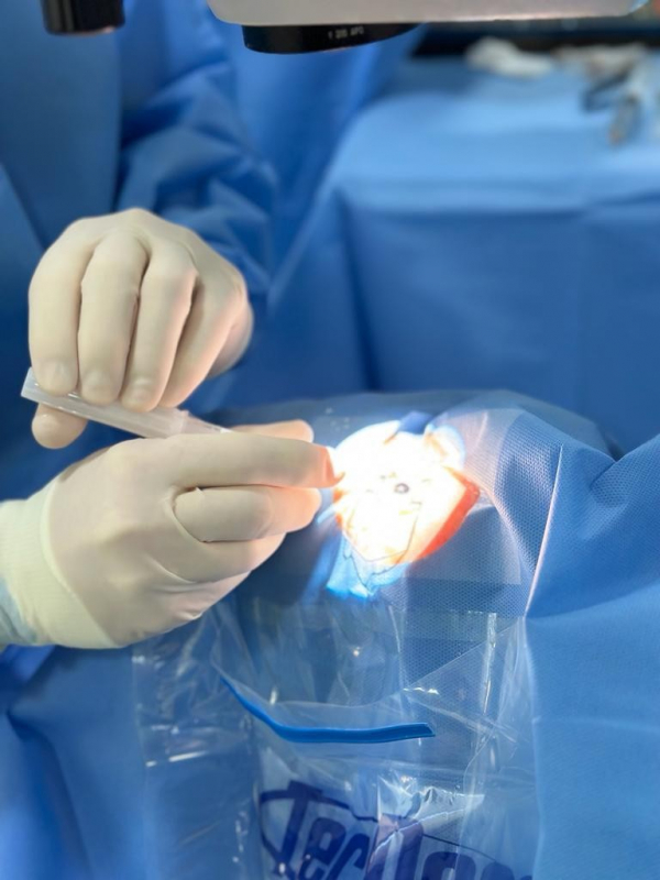 Cirurgia Catarata Laser Marcar São José dos Campos - Cirurgia para Catarata