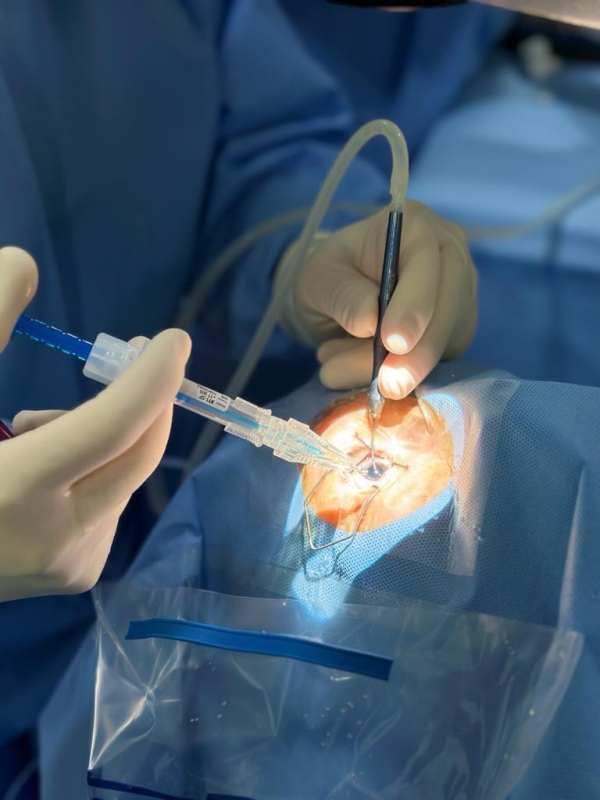 Cirurgia de Catarata Popular Marcar Vila Curuçá - Cirurgia de Catarata Valor Popular