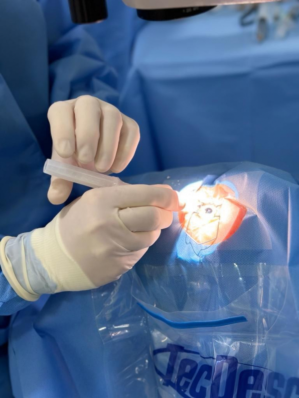 Cirurgia de Catarata por Facoemulsificação Marcar Ferraz de Vasconcelos - Facoemulsificação com Implante de Lente