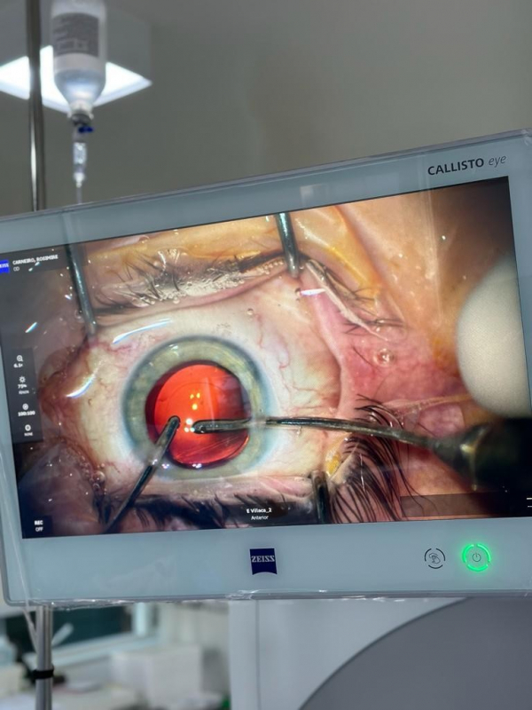 Clínica Especializada em Cirurgia a Laser para Catarata Vila Romero - Cirurgia de Catarata a Laser