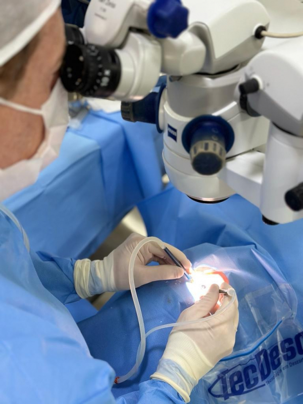 Clínica Especializada em Cirurgia de Catarata com Laser Água Funda - Cirurgia de Catarata a Laser com Implante de Lente