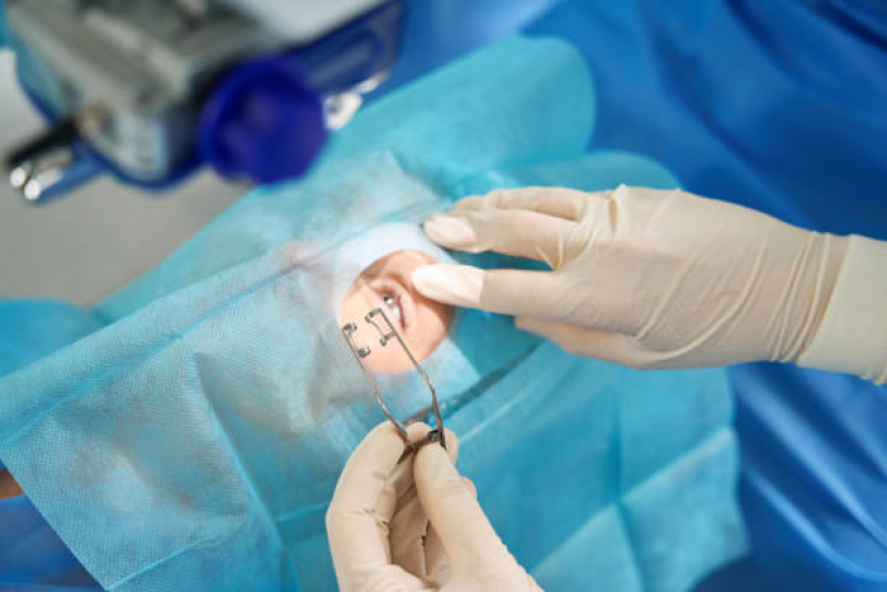 Clínica Especializada em Cirurgia de Cristalino no Olho Água Branca - Cirurgia do Cristalino