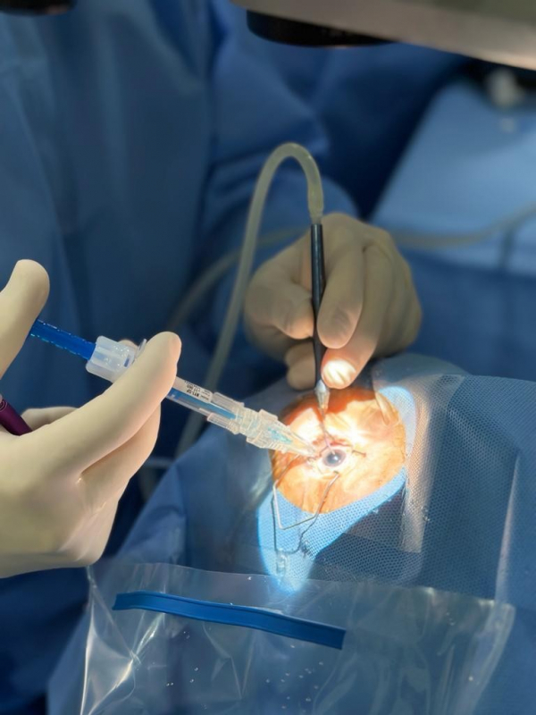 Facoemulsificação com Implante de Lente Intraocular Marcar Parque São Rafael - Facoemulsificação com Implante de Lente