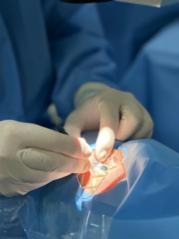 Facoemulsificação com Implante de Lente Marcar Sacomã - Facoemulsificação do Cristalino com Implantação de Lente Intraocular