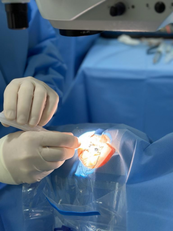 Onde Agendar Cirurgia para Catarata Cachoeirinha - Cirurgia de Catarata com Implante de Lente