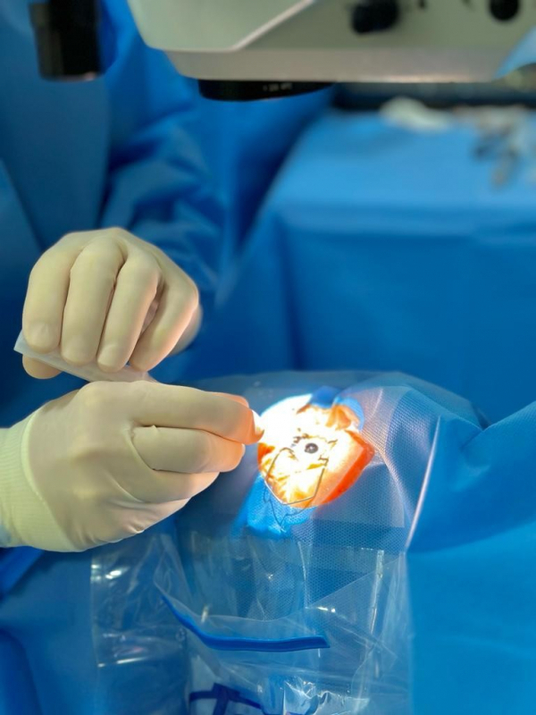 Onde Fazer Cirurgia de Catarata em Clínica Popular Engenheiro Goulart - Cirurgia de Catarata Preço Popular
