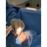 clínica especializada em cirurgia da catarata com laser Santo Amaro