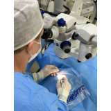 clínica especializada em cirurgia de catarata a laser com implante de lente Jardim Nove de Julho