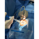 clínica que faz cirurgia a laser de catarata Jardim Helian