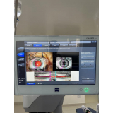 clínica que faz facoemulsificação com implante de lente intraocular Francisco Morato