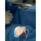 clínica que faz operação de catarata com implante de lente Caierias