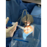 facoemulsificação com implante de lente intraocular marcar GRANJA VIANA
