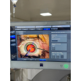oftalmo especializado em cirurgia de catarata contato  Fazenda Morumbi