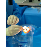 oftalmo especializado em cirurgia de catarata Lapa