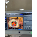 oftalmologistas especialistas em cirurgia de catarata telefone Vila Tramontano