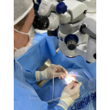 operação de catarata a laser Vila Progredior