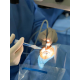 operação de catarata com implante de lente marcar Vila Gomes Cardim